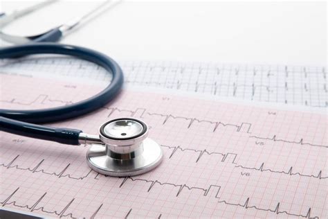 What an EKG Test Can Tell Your Doctor About Your .